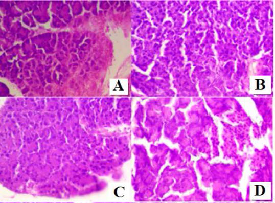 Litsea polyantha Extracts Ameliorate Diabetes and Oxidative Stress in Streptozocin-induced Diabetic Rats