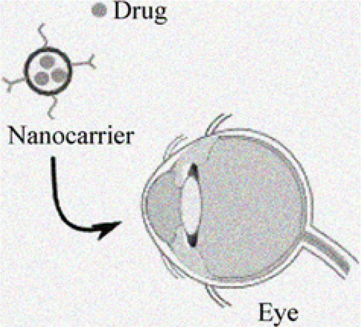 Formulation Considerations and Application of Nanostructured Lipid Carriers (NLC) for Ocular Delivery