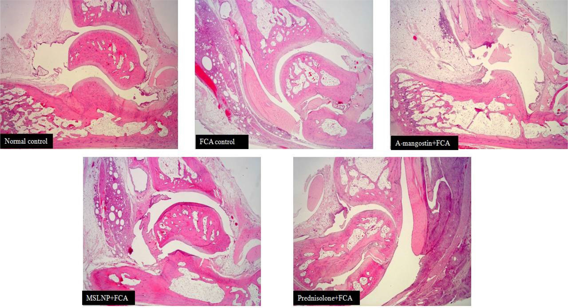 Amelioration of Freund Complete Adjuvant-induced Rheumatoid Arthritis by Formulated Solid Lipid Nanoparticle of α-Mangostin in Rat Model