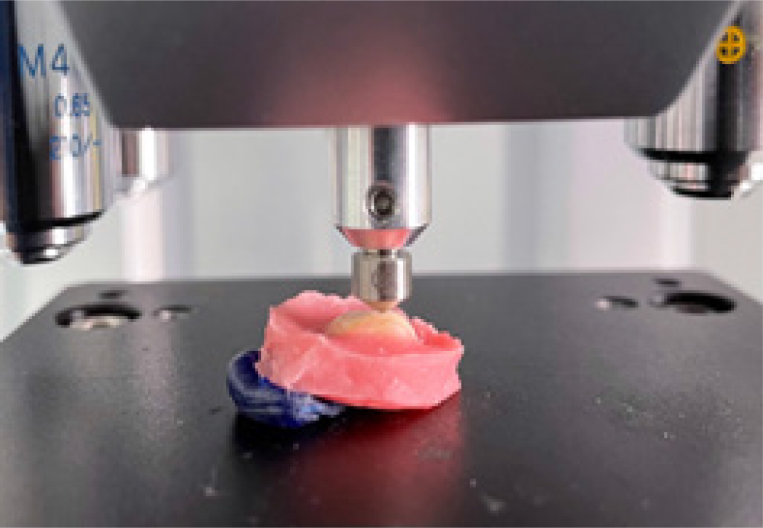 Comparative Evaluation of Microhardness of Two Conventional and Hydrophilic Fissure Sealants: An in vitro Study