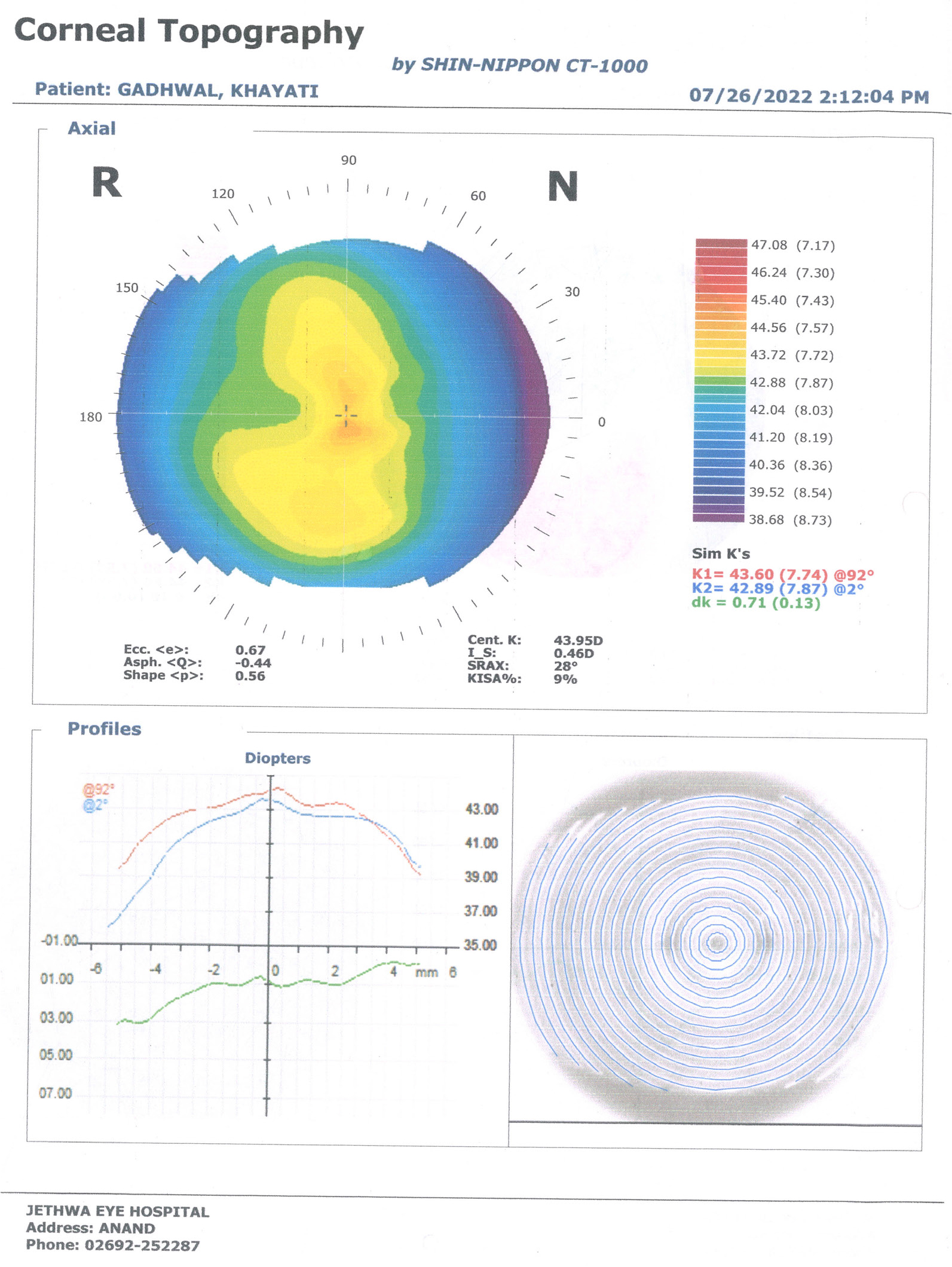 A Rare Case Report on Lagophthalmos