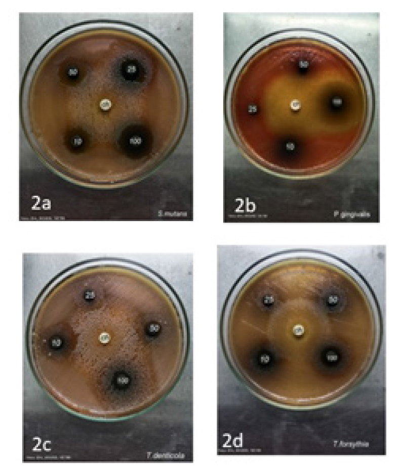 Novel Antibacterial Activity and Time Kill Kinetics of Ethanolic Extract of Ipomea marginata against Select Oral Micro-organisms Causing Gingivitis-An in vitro Study