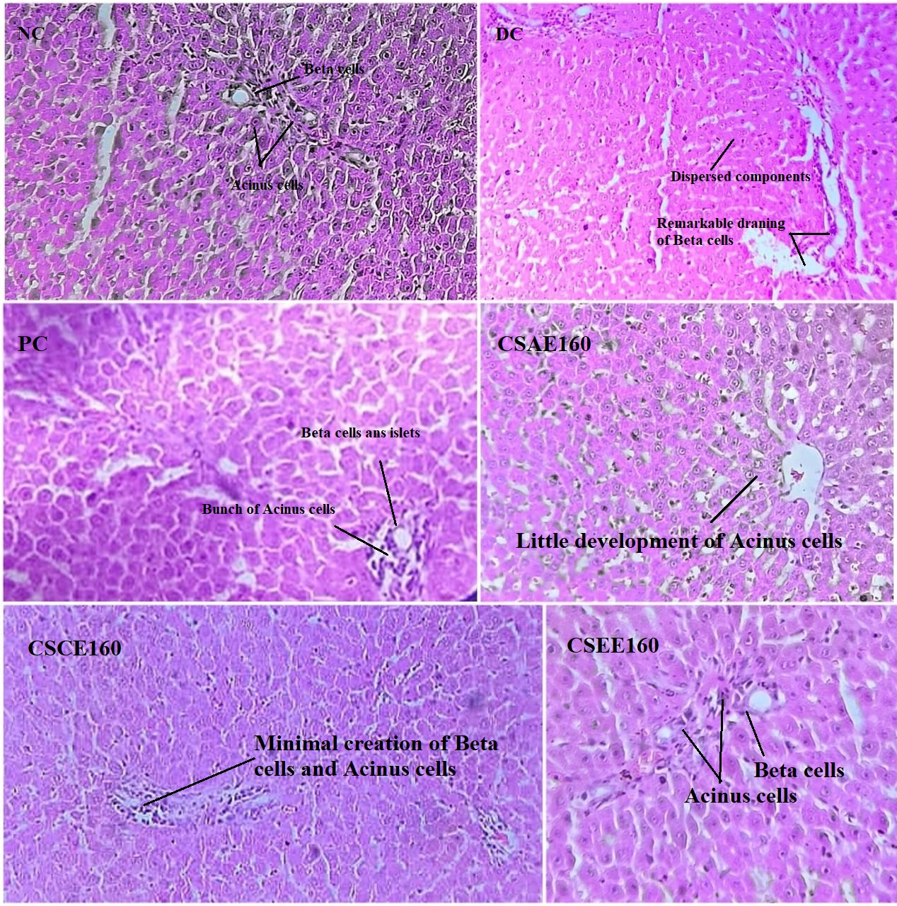 Antidiabetic, Antihyperlipidemic and Protective Effect of Cupressus sempervirens L. Leaves Extract in Streptozotocin Induced Diabetic Rats