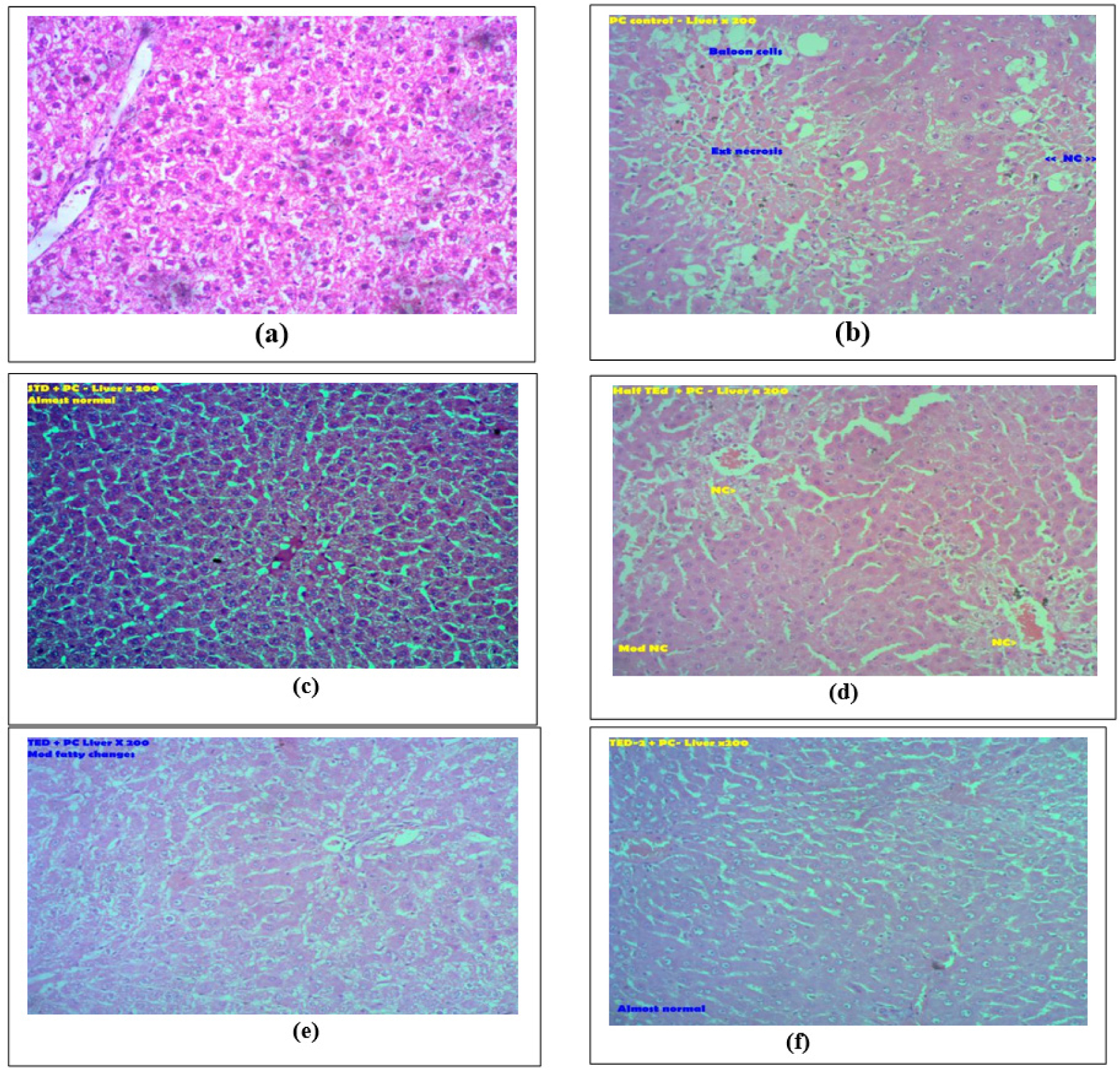 Hepatoprotective Effect of Whole Plant Powder Leucas aspera Spreng