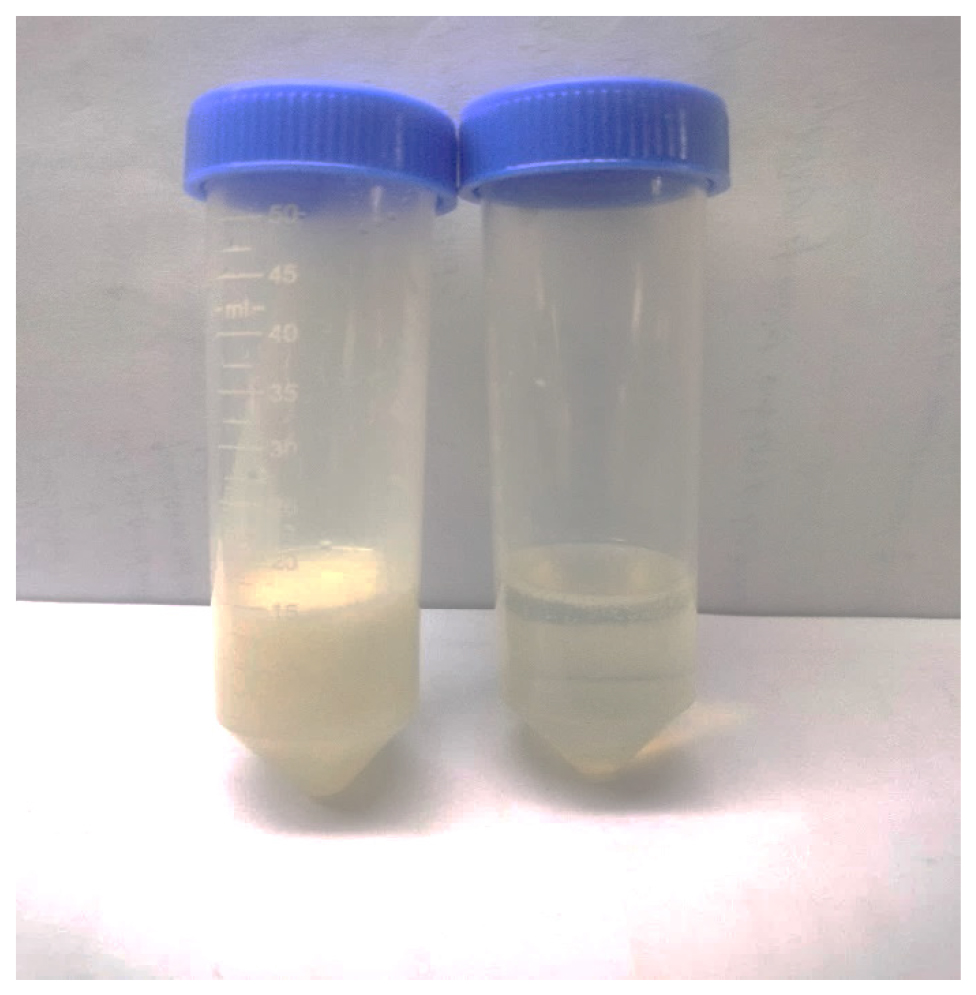 Spontaneous Emulsification as a Novel Approach for the Preparation and Characterization of Curcumin Nanoemulsion: Advancing Bioavailability and Therapeutic Efficacy