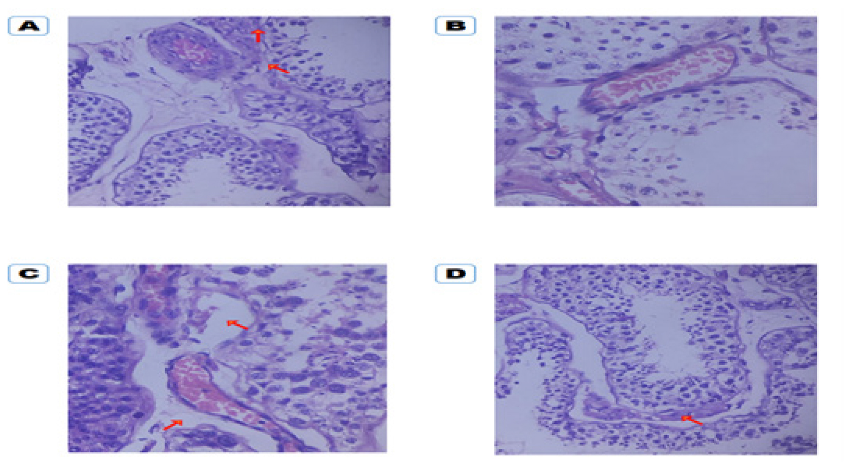 Histopathological Variation on Testis of Sex Reassignment Surgery (SRS) Transgenders on Hormonal Therapy