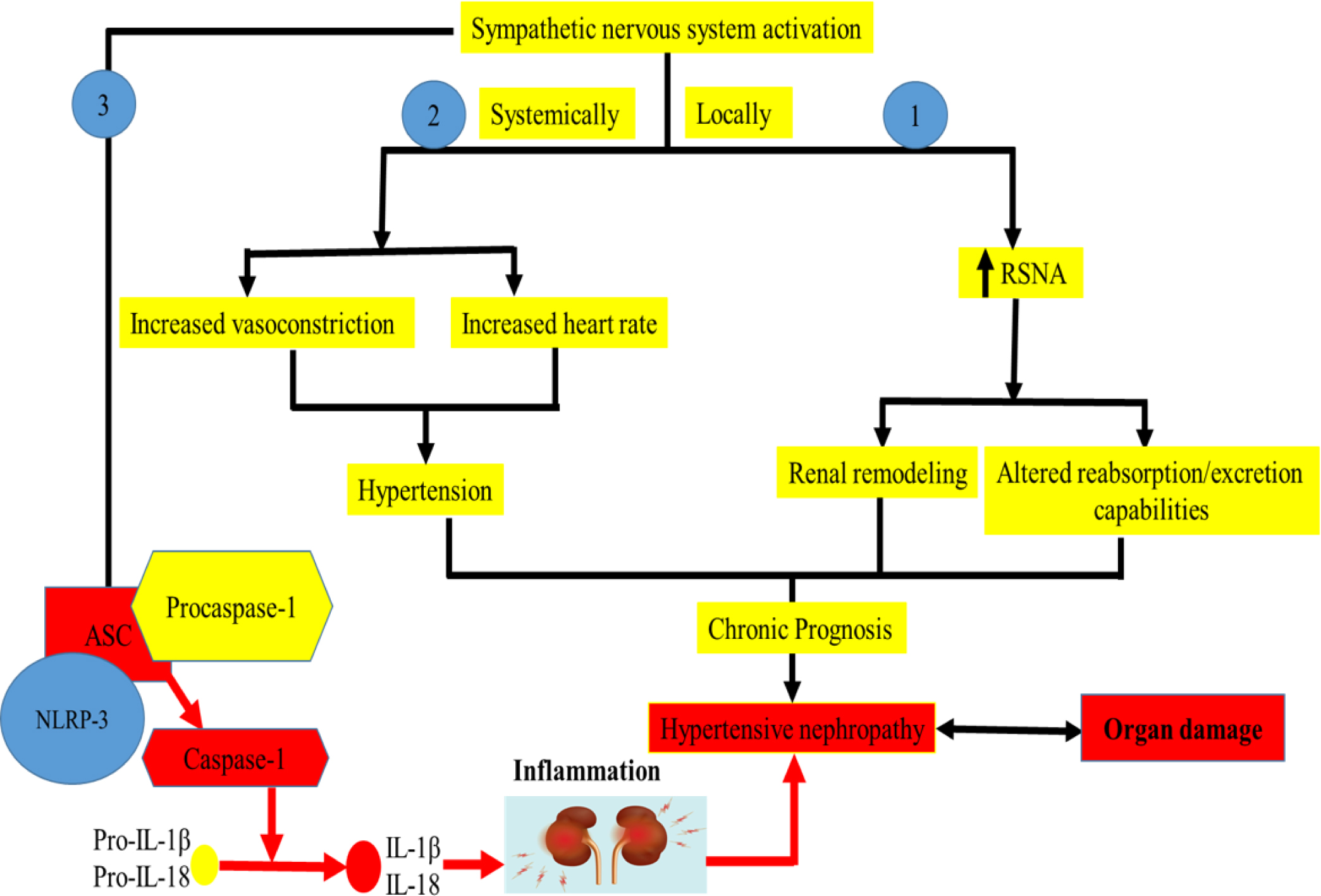 ROS-Mediated NLRP3 Inflammasome Activation in the Progression of Hypertensive Nephropathy and its Therapeutic Interventions