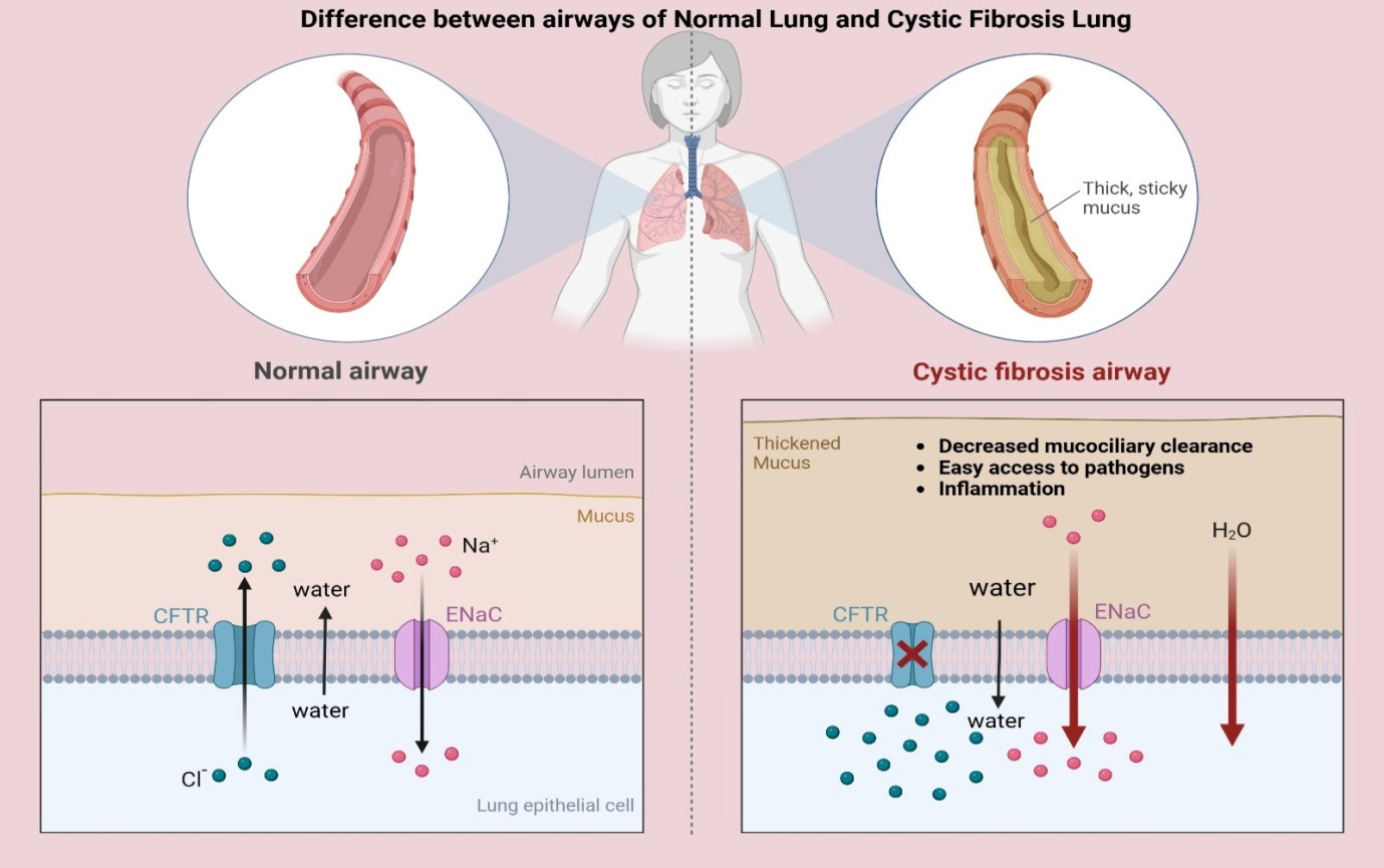 A Focus on Cystic Fibrosis Transmembrane Regulator (CFTR) Genetic Lesions, Phenotype Expressions and Emerging Therapies for Cystic Fibrosis: An Update