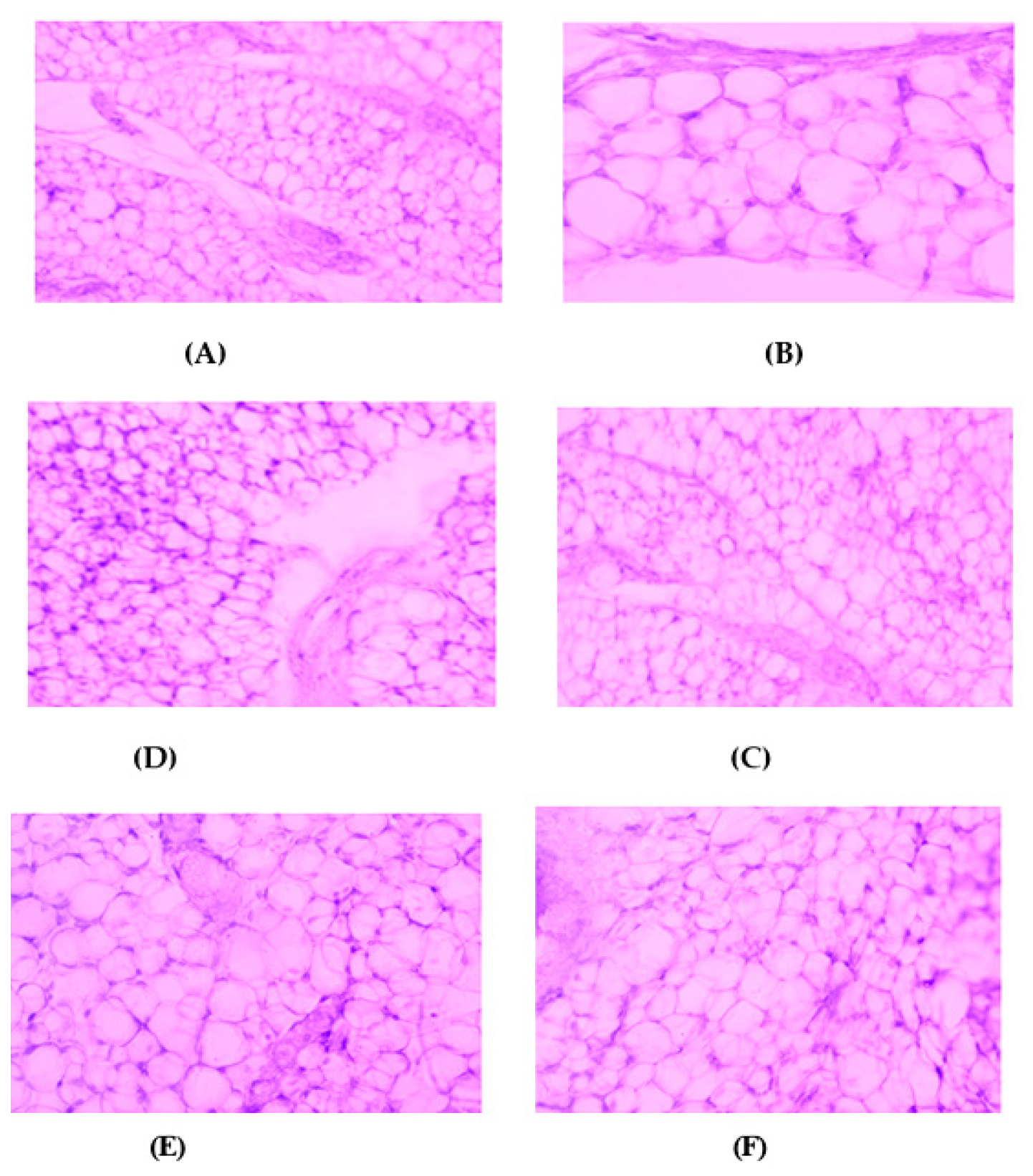 Exploring the Potential of 5-HT1 Receptor Subtypes as Therapeutic Targets for Obesity Treatment in Animal Models