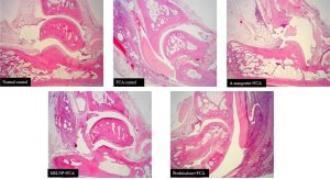 Amelioration of Freund Complete Adjuvant-induced Rheumatoid Arthritis by Formulated Solid Lipid Nanoparticle of α-Mangostin in Rat Model
