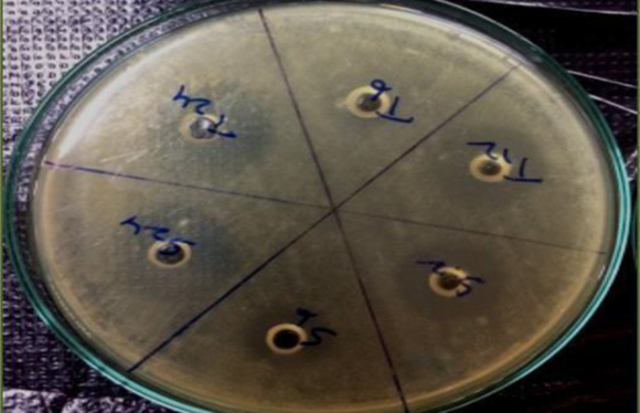 Development and Validation of Microbiological Analytical  Method for Determination of Potency of Voriconazole Tablets
