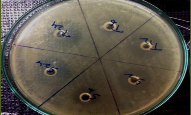 Development and Validation of Microbiological Analytical  Method for Determination of Potency of Voriconazole Tablets